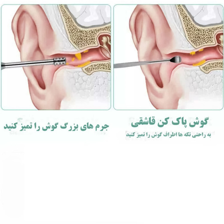 مجموعه نظافت گوش مدل EarCare-10 بسته 6 عددی